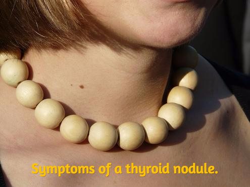 What are treatment options for thyroid cysts and nodules?
